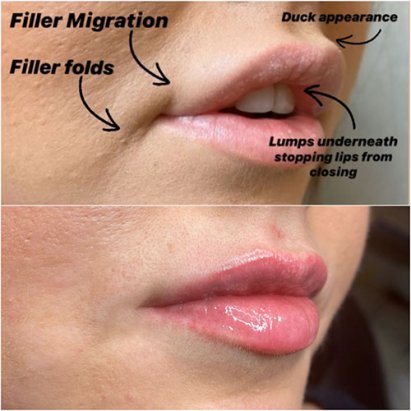 Советы по уходу за кожей и макияжу, чтобы сделать губы пухлыми и полными!