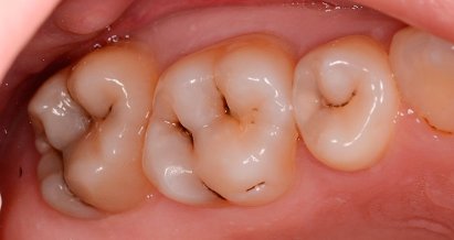 Диагностика и лечение заболеваний зубов
