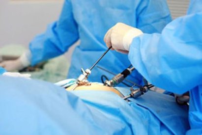 Лапароскопия: когда назначают и преимущества процедуры