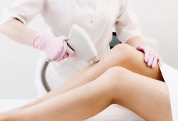 Лазерная эпиляция: готовимся к процедуре