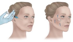 Каверзные вопросы для косметолога